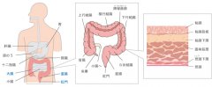 香港十大常见癌症之一 - 大肠癌